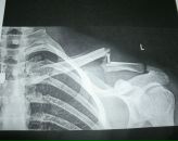 Фотография Скотникова Славы