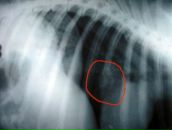 Фотография Дагли Кавы